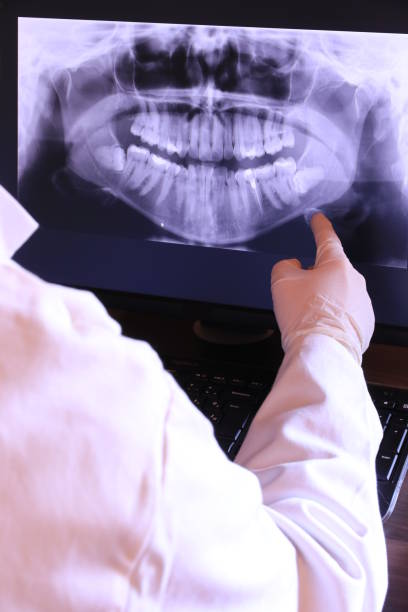 Best Emergency Tooth Extraction in Roland, OK