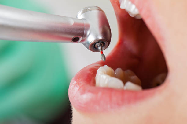 Best Urgent Care for Lost Fillings or Crowns in Roland, OK